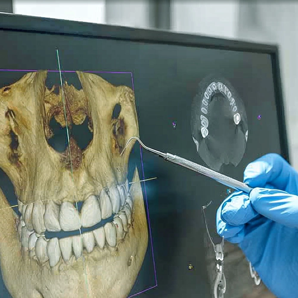 3D skull scan highlighting jaw structure on screen.