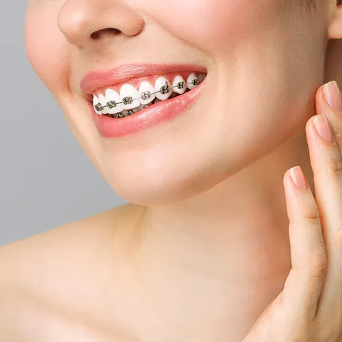 smiling woman wearing dental braces