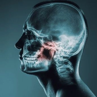 X-ray of a human head highlighting the temporomandibular joint (TMJ).