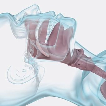 Anatomy of the throat and upper airway, showing the epiglottis, larynx, and trachea.